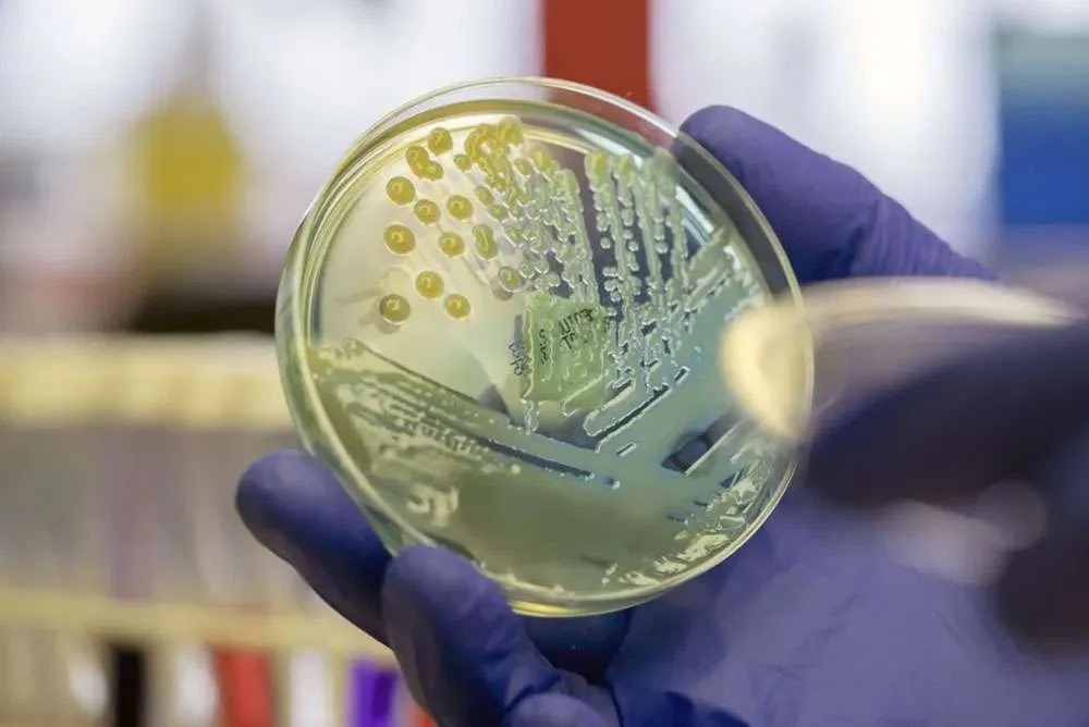 A recent report suggests that superbugs might reduce life expectancy by nearly two years. Here’s what you need to understand about antimicrobial resistance